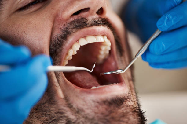 Best Emergency TMJ Treatment in Richardson, TX