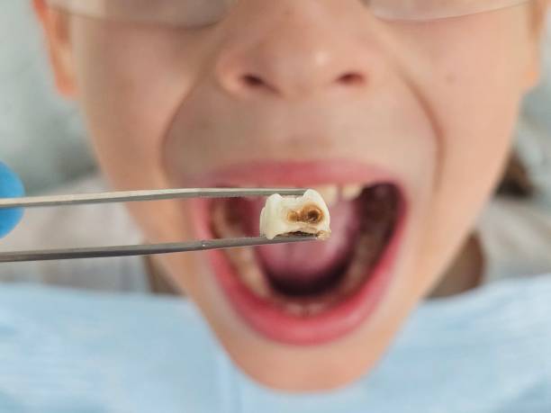 Best Cosmetic Emergency Dentistry in Richardson, TX